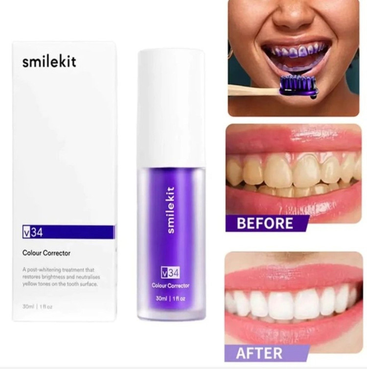 سفید کننده دندان اسمایل کیت مدل V34 حجم 30ML